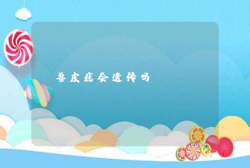 【兽皮痣会遗传吗】,第1张