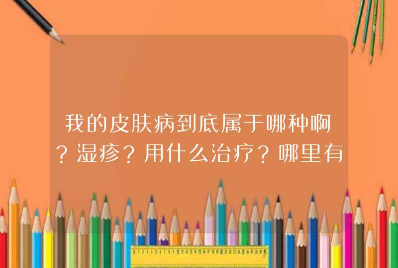 我的皮肤病到底属于哪种啊？湿疹？用什么治疗？哪里有治疗效果好的医院,第1张