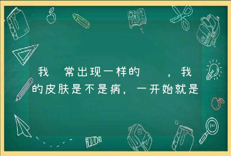 我经常出现一样的问题，我的皮肤是不是病，一开始就是胃痛接到就是，！身上发痒，一抓了，就起俩一身的疙,第1张