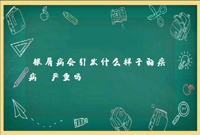 银屑病会引发什么样子的疾病？严重吗？,第1张