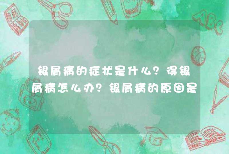 银屑病的症状是什么？得银屑病怎么办？银屑病的原因是什么？,第1张