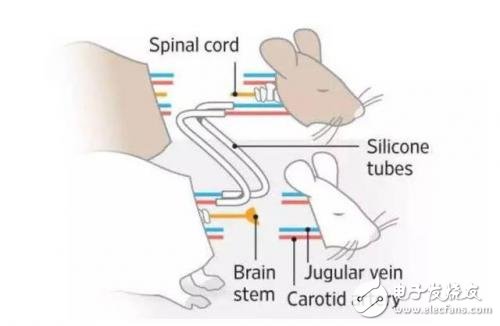 遗体换头手术成功，换头手术离真正的成功还远吗？,第2张
